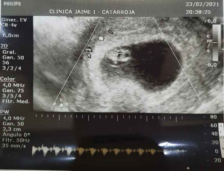 Futuras mamás octubre 2021 - 2