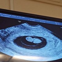 futuras mamis mayo 2022 🤰 - 1