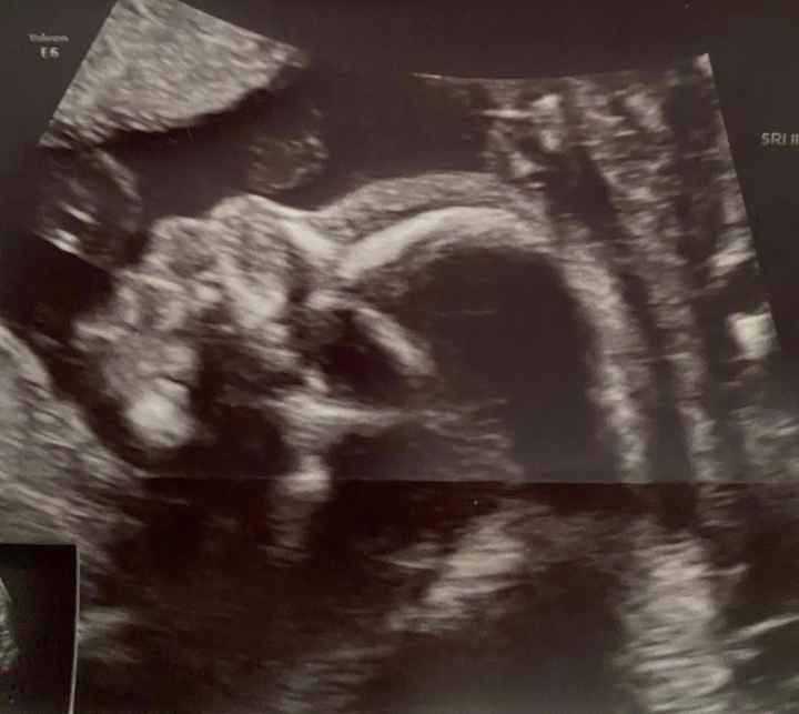 Futuras mamas octubre 2020 - 1