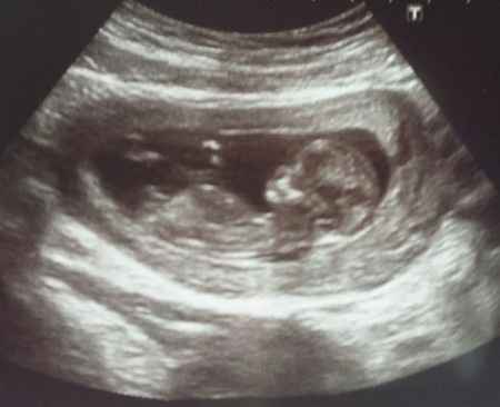 El consultorio de Lita para futuras mamis - 1