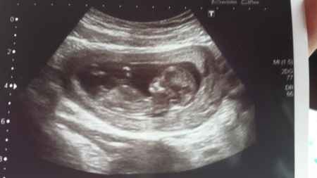 El consultorio de Lita para futuras mamis - 2