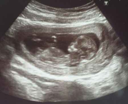El consultorio de Lita para futuras mamis - 1