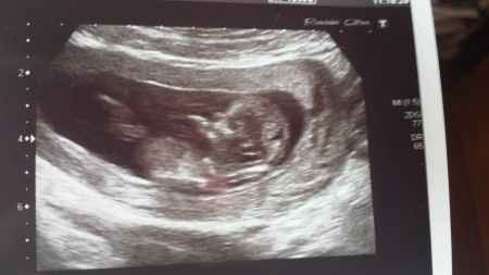 El consultorio de Lita para futuras mamis - 2