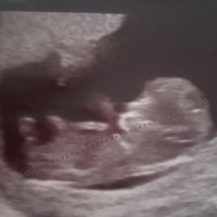 Futuras Mamis Abril 2022 🤰 - 1