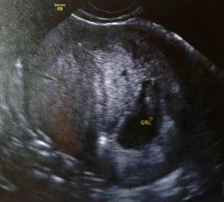 MI BEBE 2º