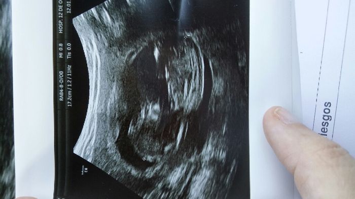 Futuras mamas julio 2016 - 1