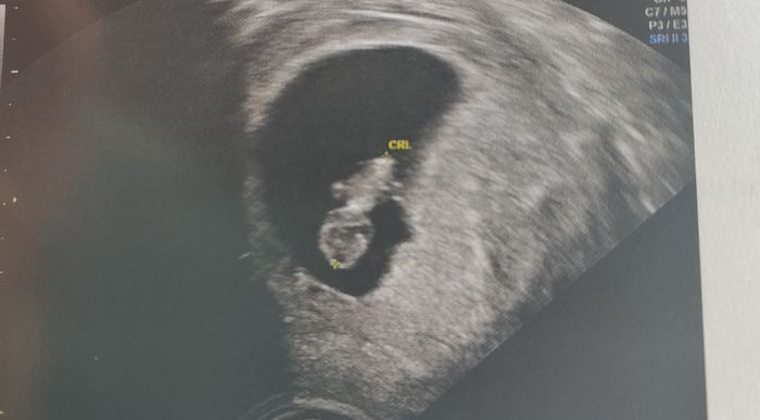 Futuras mamás Octubre 2022 🤰♥️ 1