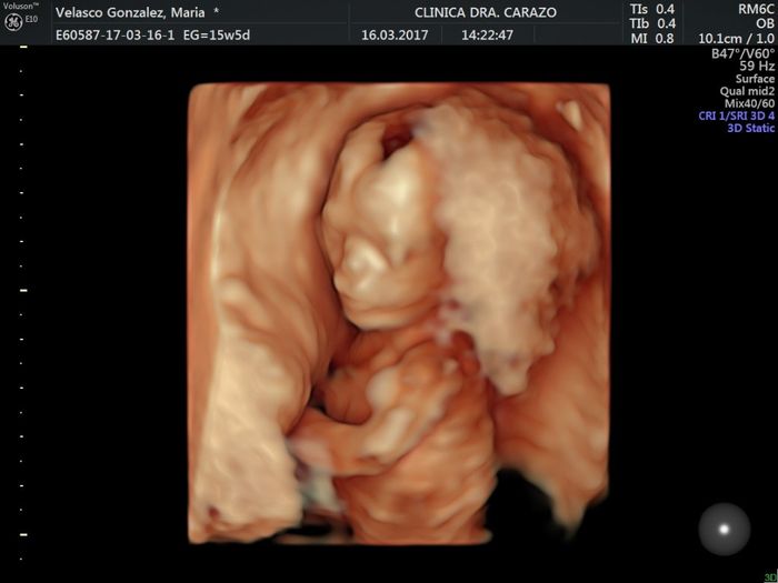 16 semanas