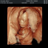 16 semanas