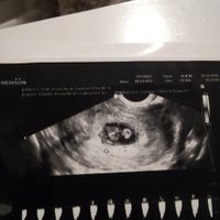 Ayuda con método ramzi: niño o niña? - 1
