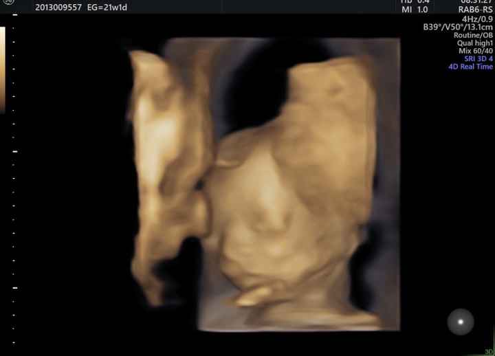 Futuras mamis Febrero 2021 - 2