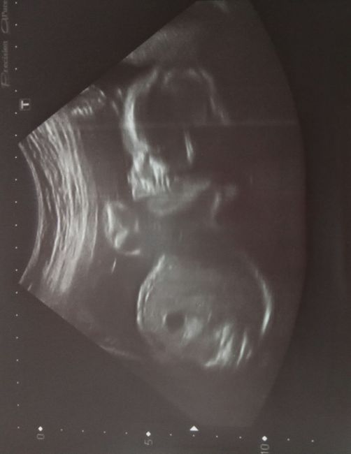 Nuevo! Futuras mamas Septiembre 2018 1