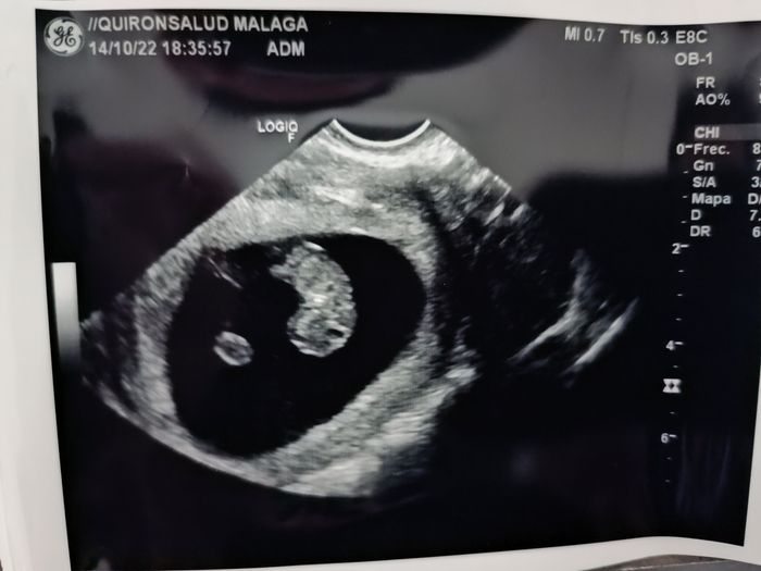 Futuras mamis mayo 2023 2