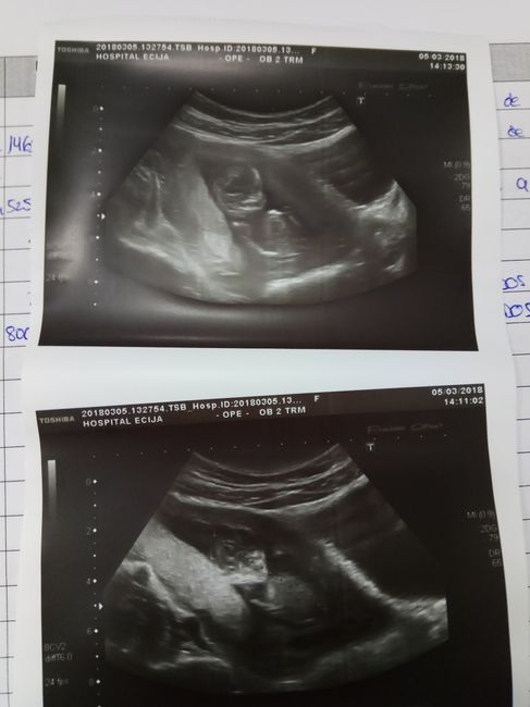 Nuevo! Futuras mamas Septiembre 2018 1