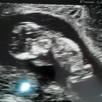 Futuras mamás junio 2016 - 1