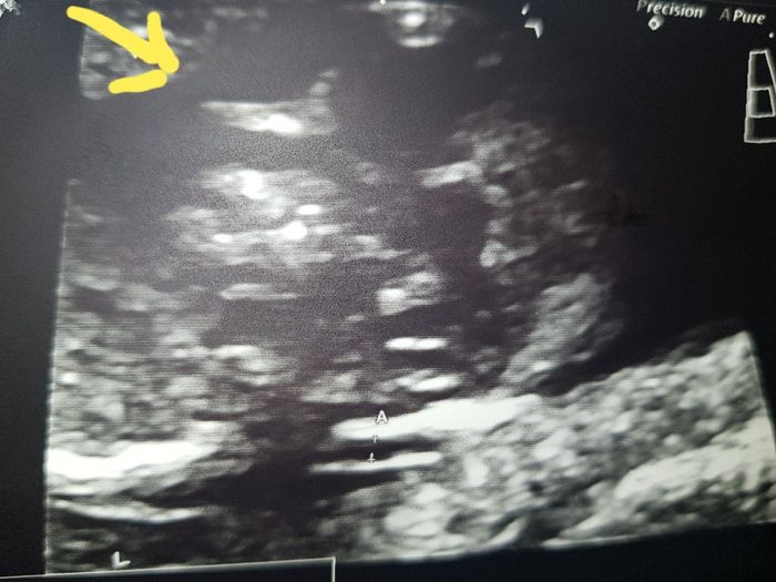 Futuras mamis diciembre 2019 oficial - 2