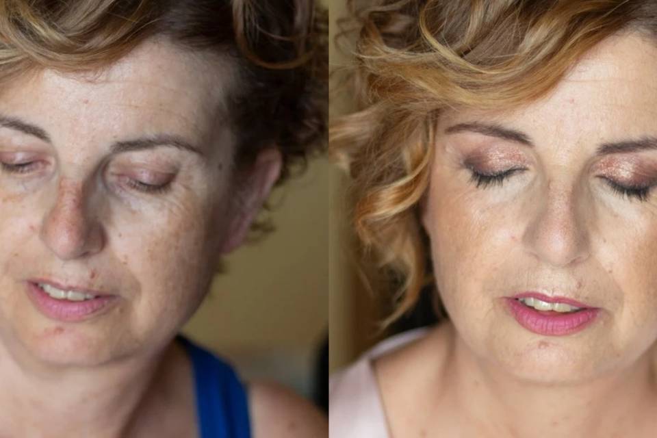 Antes y después piel madura