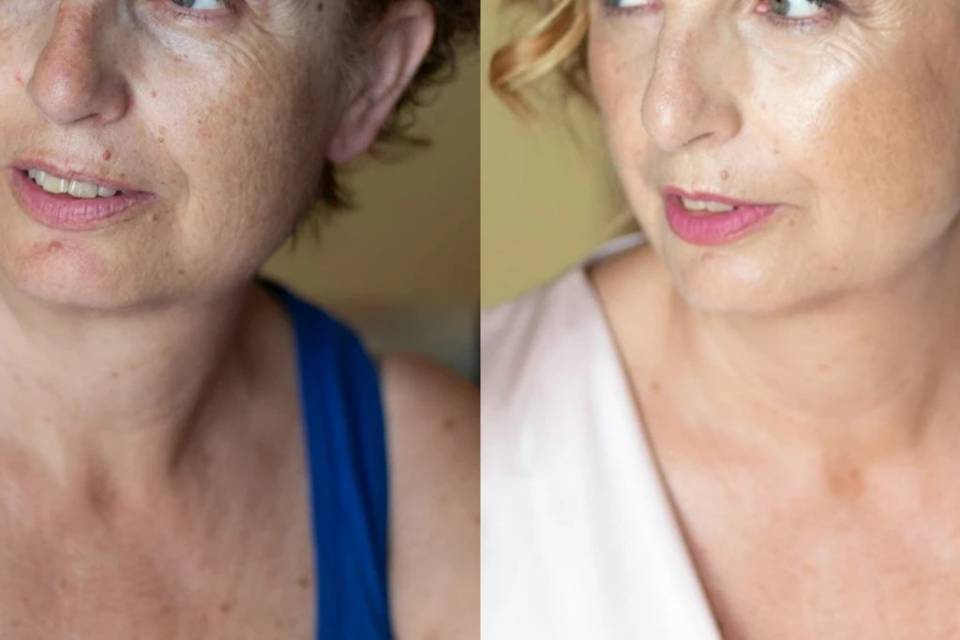 Antes y después piel madura