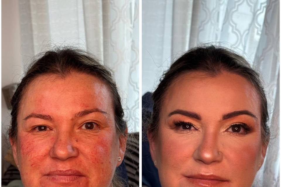 Antes y después