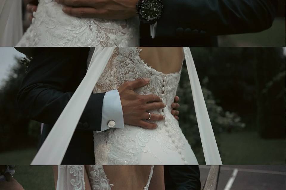Detalles