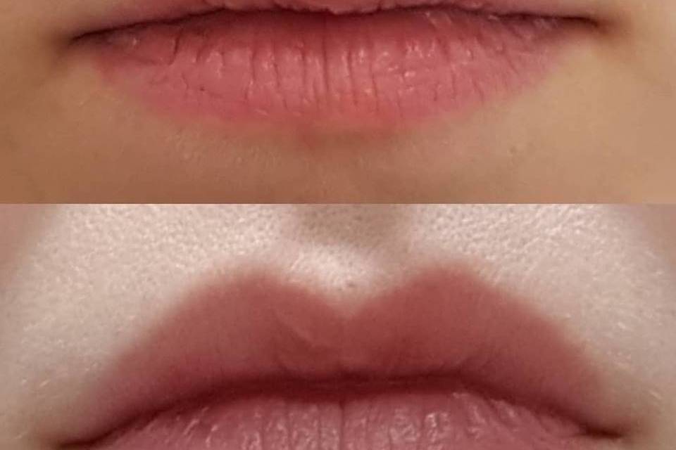 Antes y después