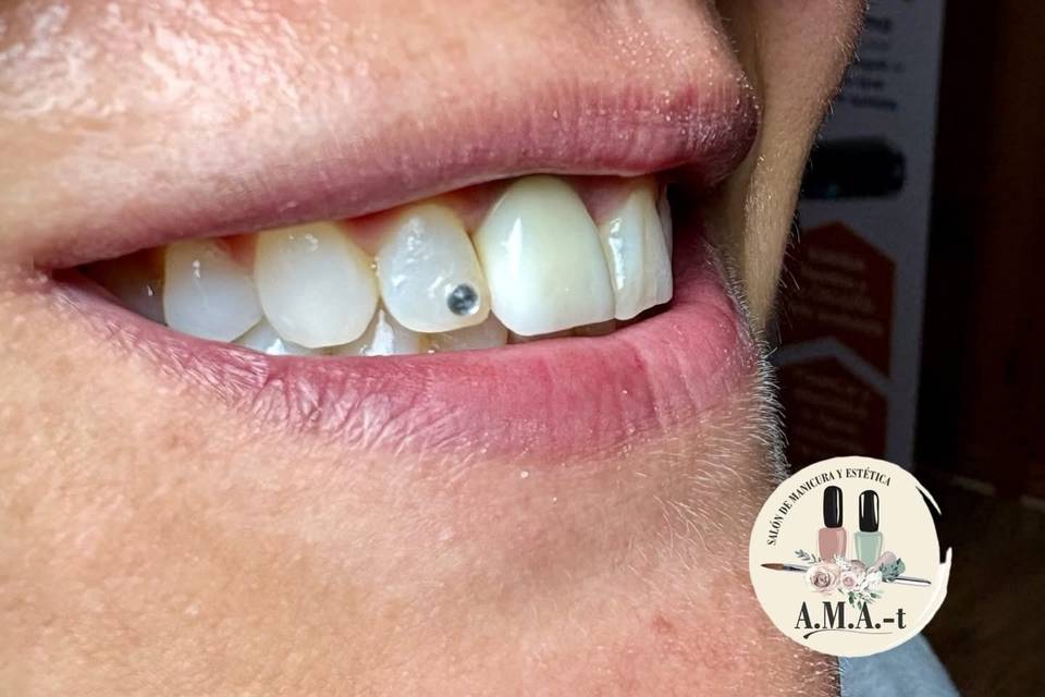 Joyeria dental