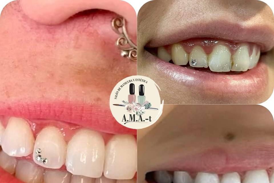 Joyeria dental