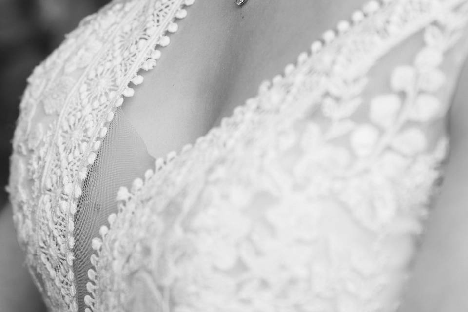 Detalles