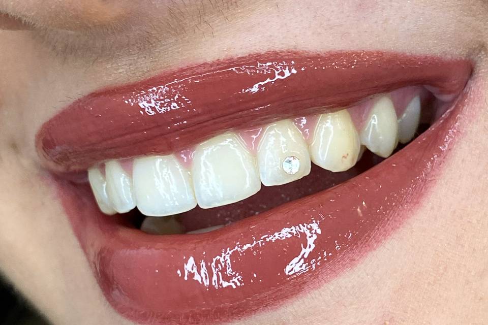 Gemas dentales