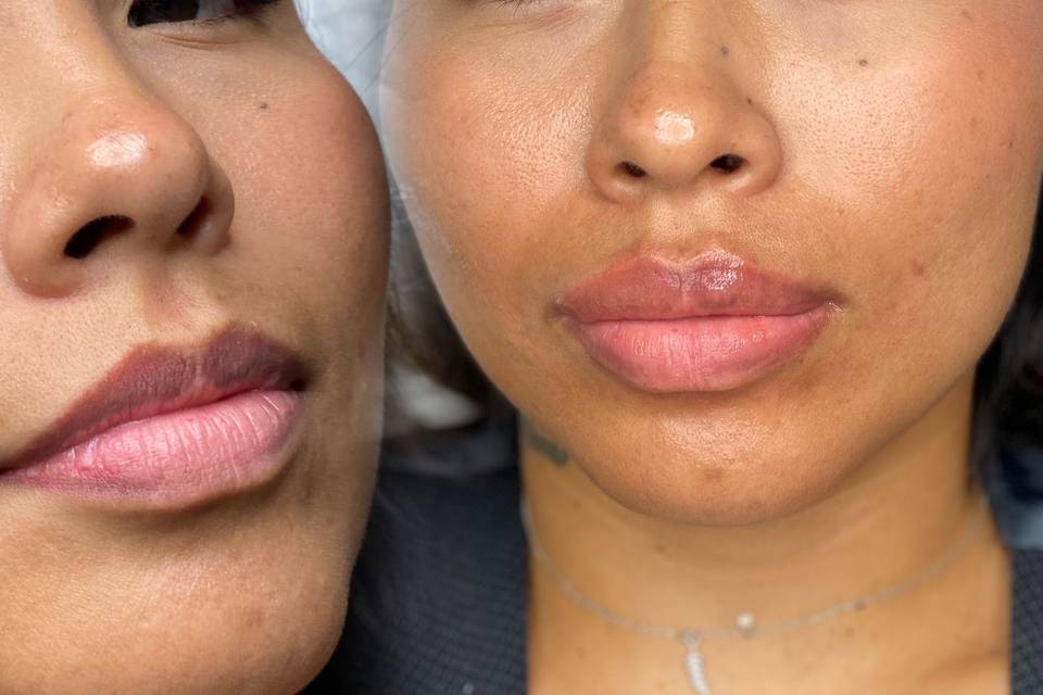 Micropigmentación de labios