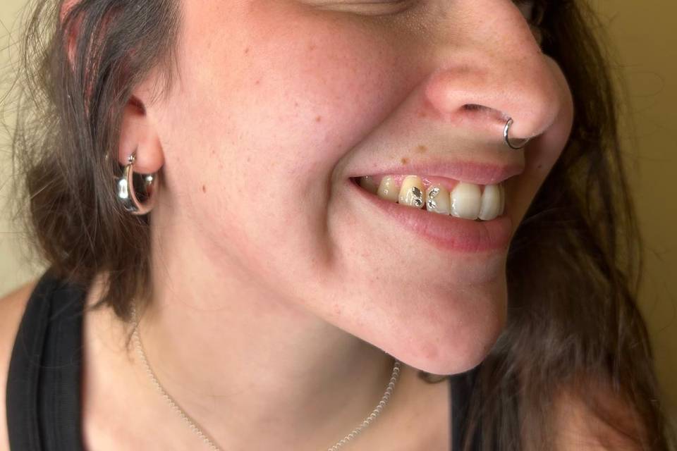 Gemas dentales