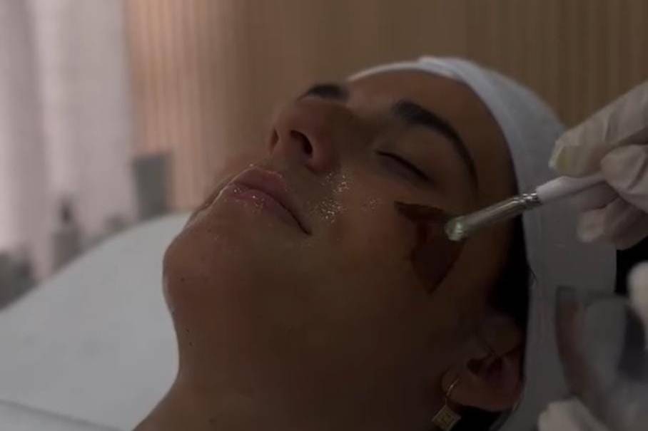 Peeling facial