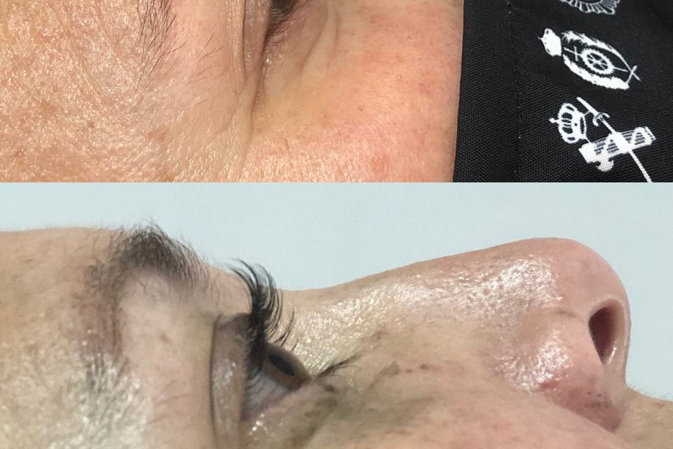 Microblading