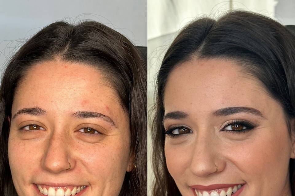 Párpado encapotado