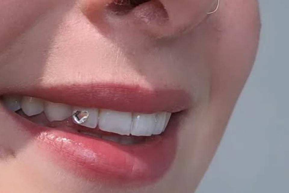 Gemas dentales con formas