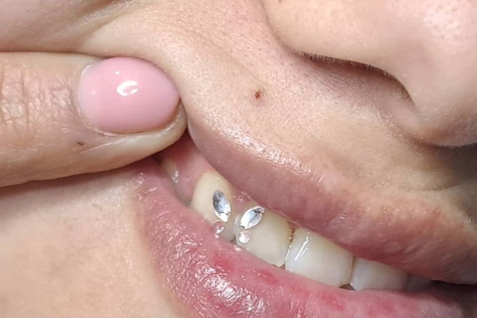 Figuras echas con gemas dental