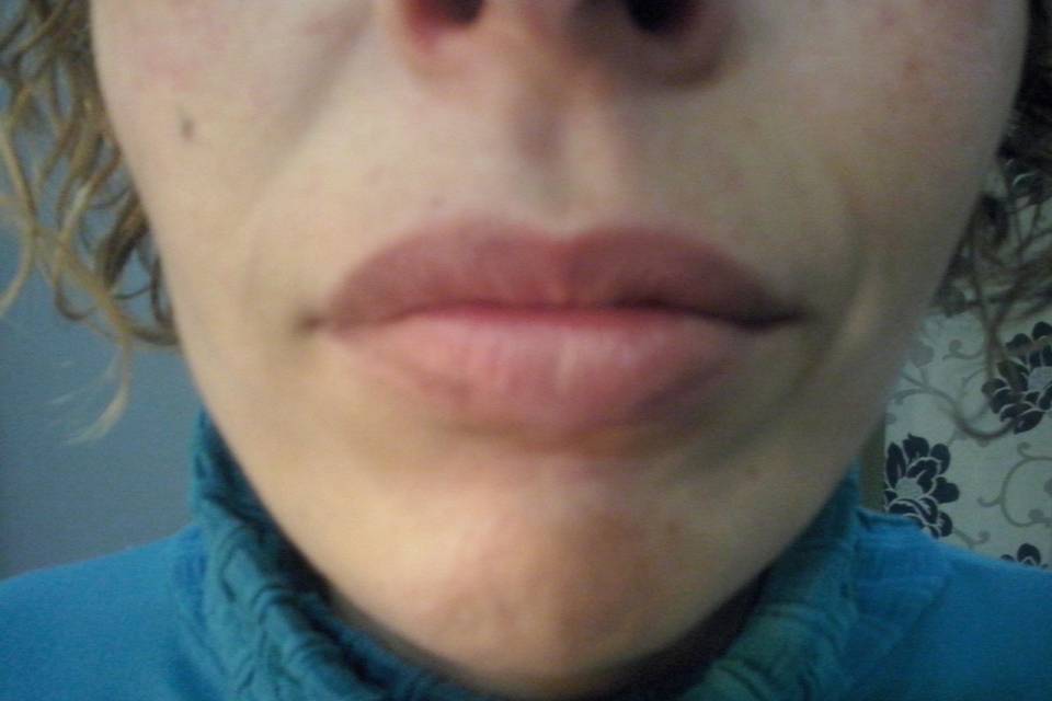 Micropigmentación de labios (antes)