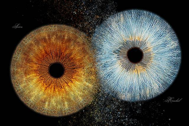 Iristellar