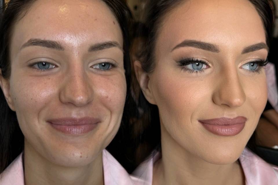antes-despues