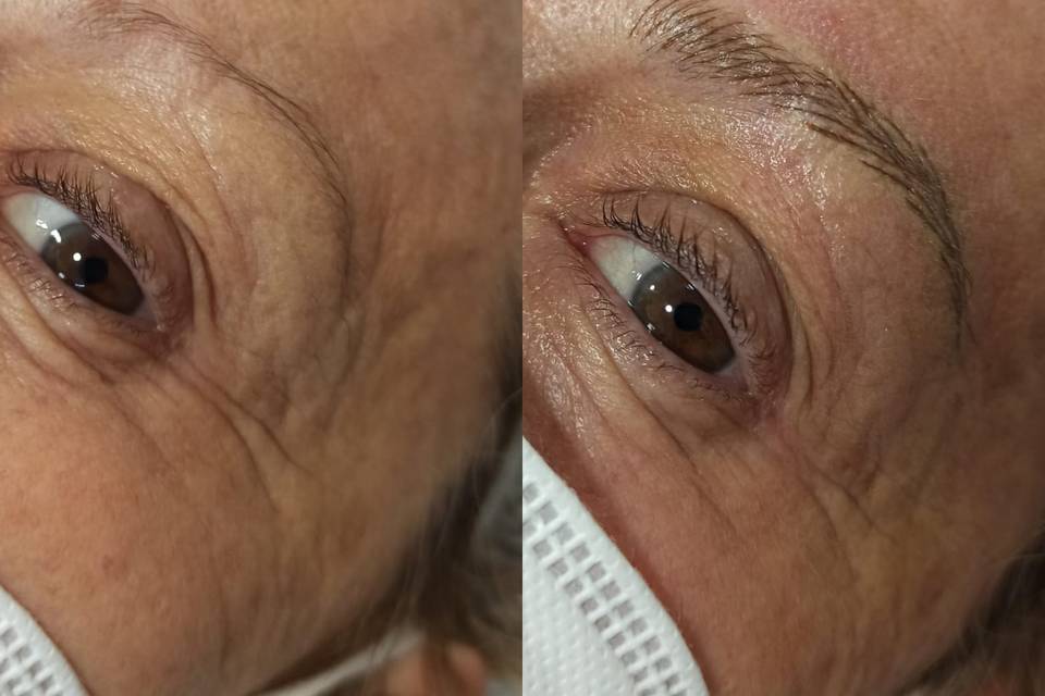 Microblading