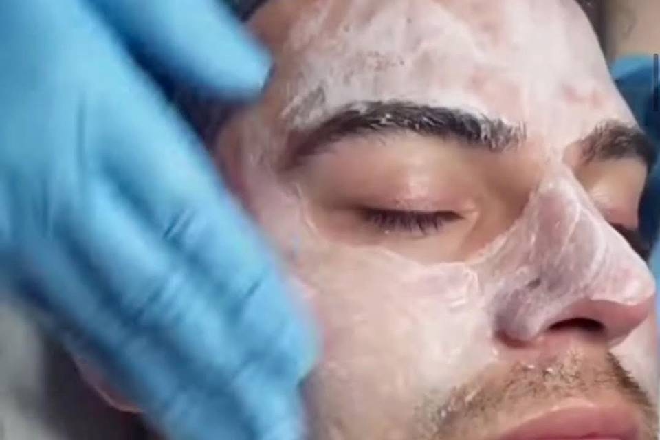 Tratamiento facial