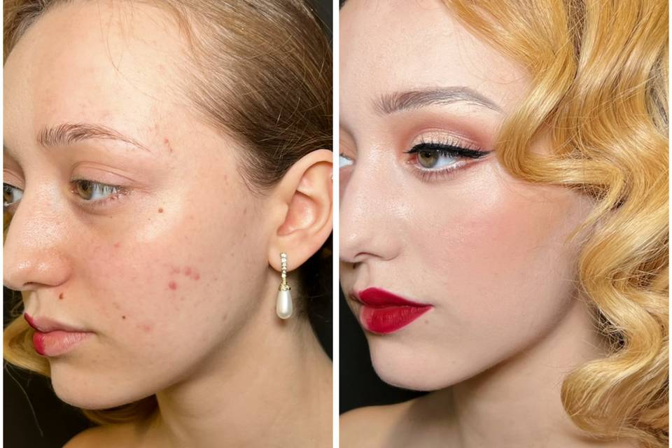 Antes y después