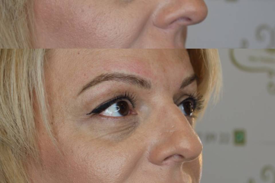 Microblading antes y después