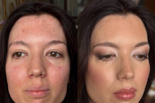 Antes/Después
