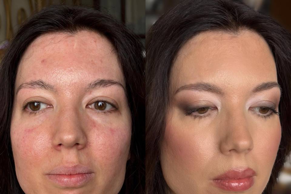 Antes/Después