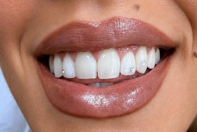 Biensana gemas dentales