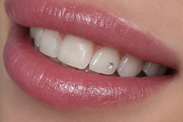 Biensana gemas dentales