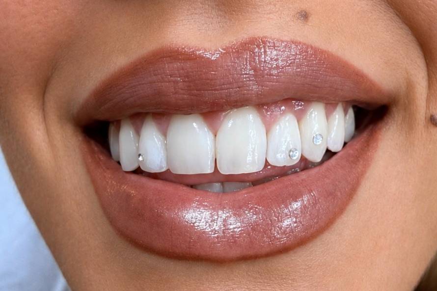 Biensana gemas dentales