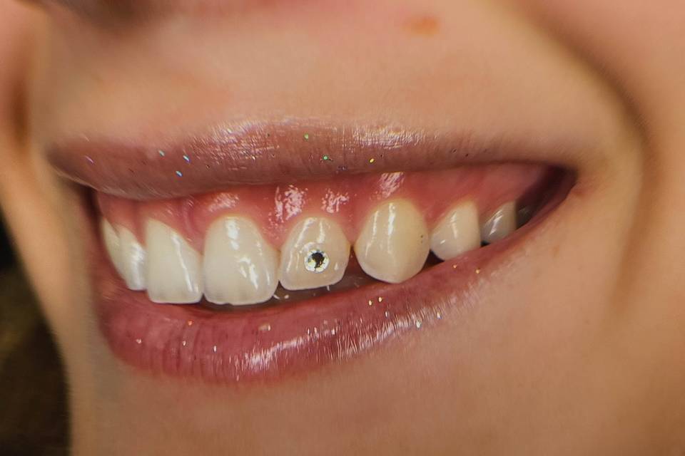 Gemas dentales