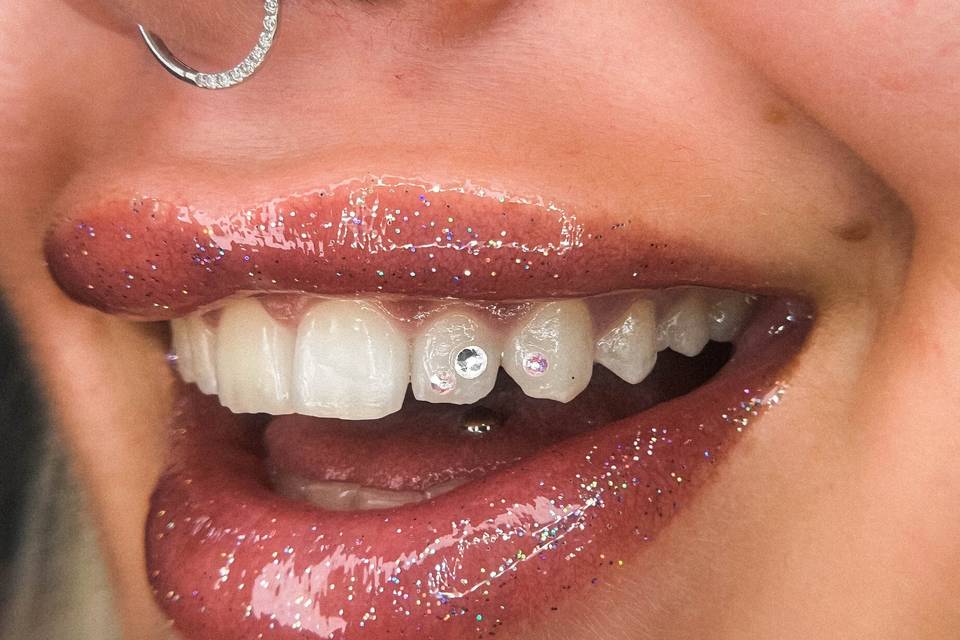 Gemas dentales